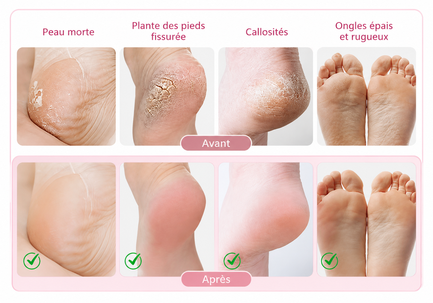 Râpe Électrique pour Pieds