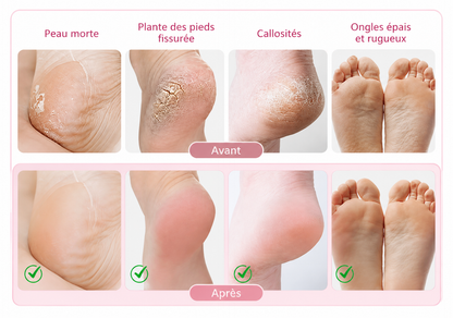 Râpe Électrique pour Pieds